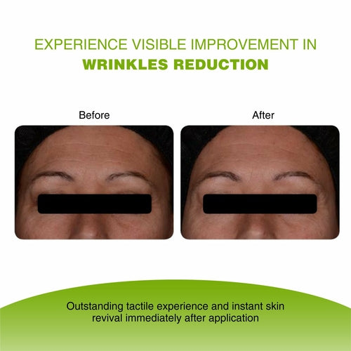 Vijuve Vitamin C Face Serum with Double Hyaluronic Acid and Collagen