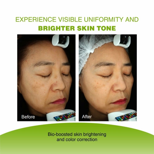 Vijuve Vitamin C Face Serum with Double Hyaluronic Acid and Collagen